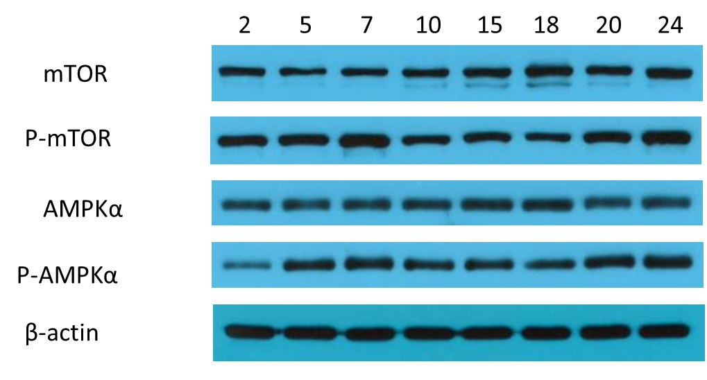 直播预告如何高效地做出漂亮的westernblot